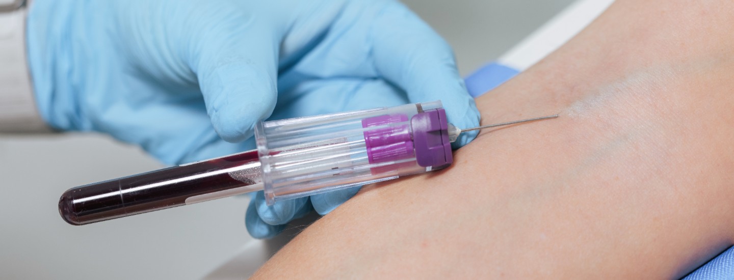 Blood Testing Rr Header Desktop