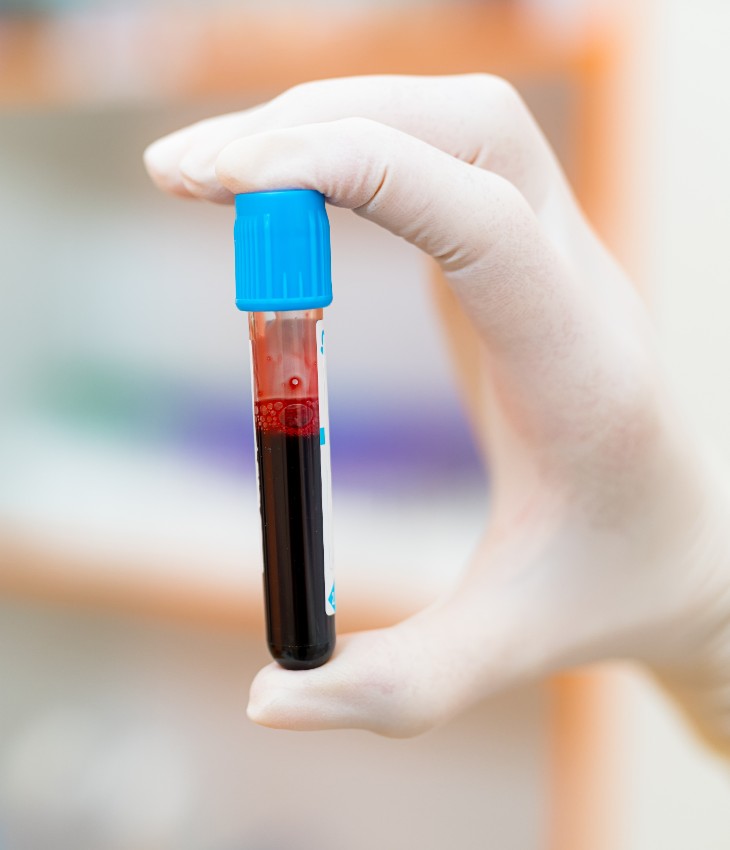 Bloodtesting Rr