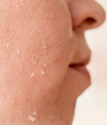 Dull Dry Skin Conditions Feat Rr