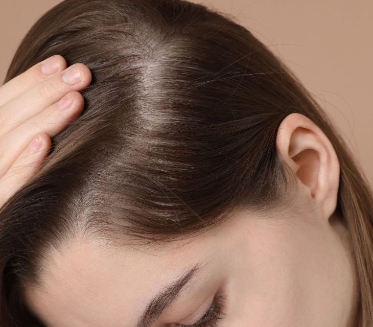 Hair Loss Conditions Feat Rr