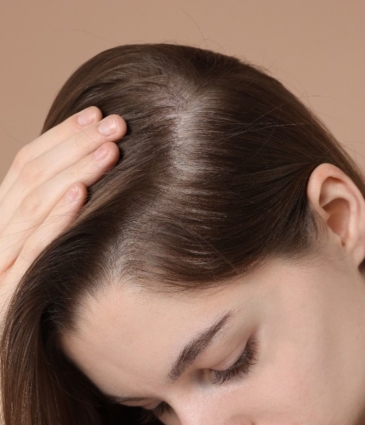 Hair Loss Conditions Head Rr