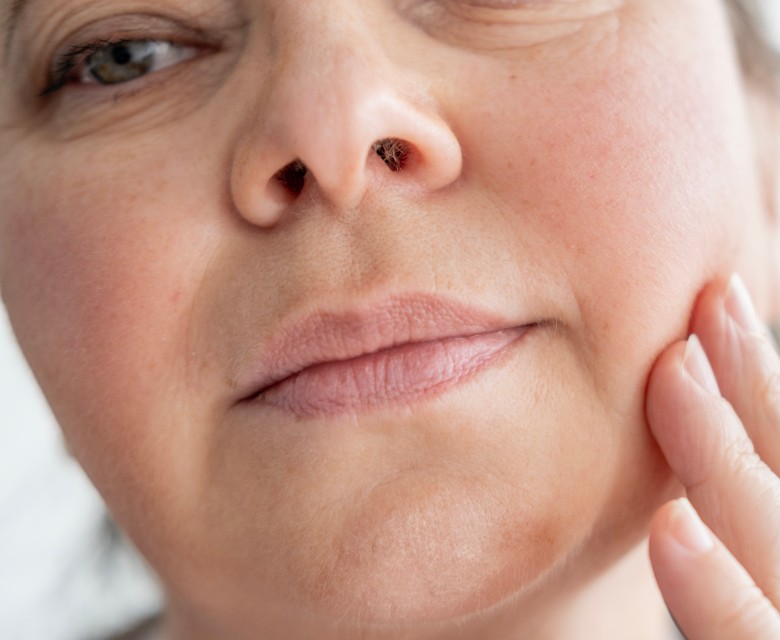 Jowls Conditions Head Rr