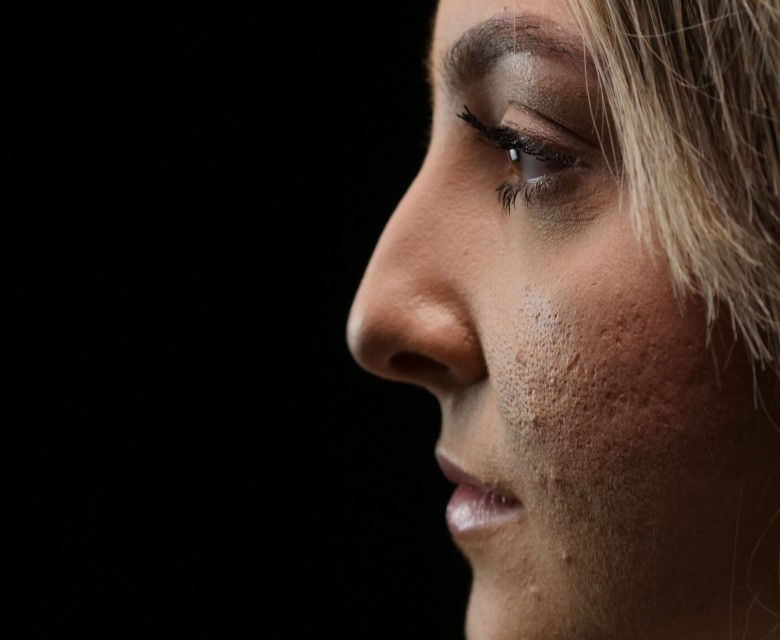 Mishapen Nose Conditions Head Rr