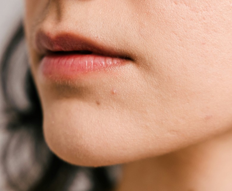 Thin Lips Conditions Head Rr