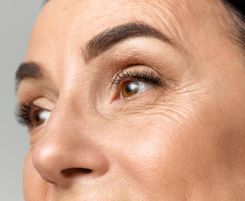 Wrinkles Conditions Head Rr